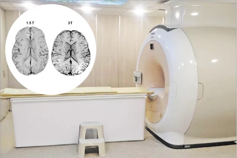 Де зробити МРТ у Чернівцях